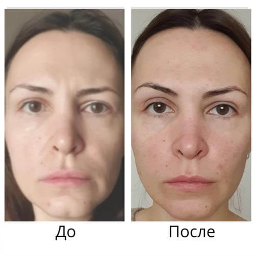 Результат до и после