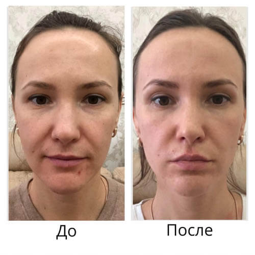 Результат до и после